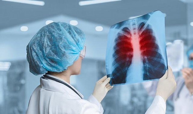 Zatürre (pnömoni) nedir? Zatürre belirtileri nelerdir?