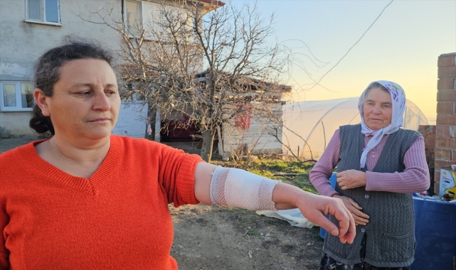 Çorum'da köpeğin saldırısına uğrayan 3 kişi yaralandı